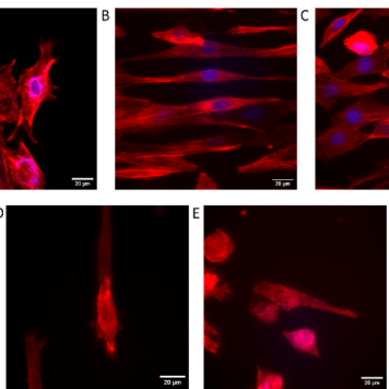 Elongated cells on substrates